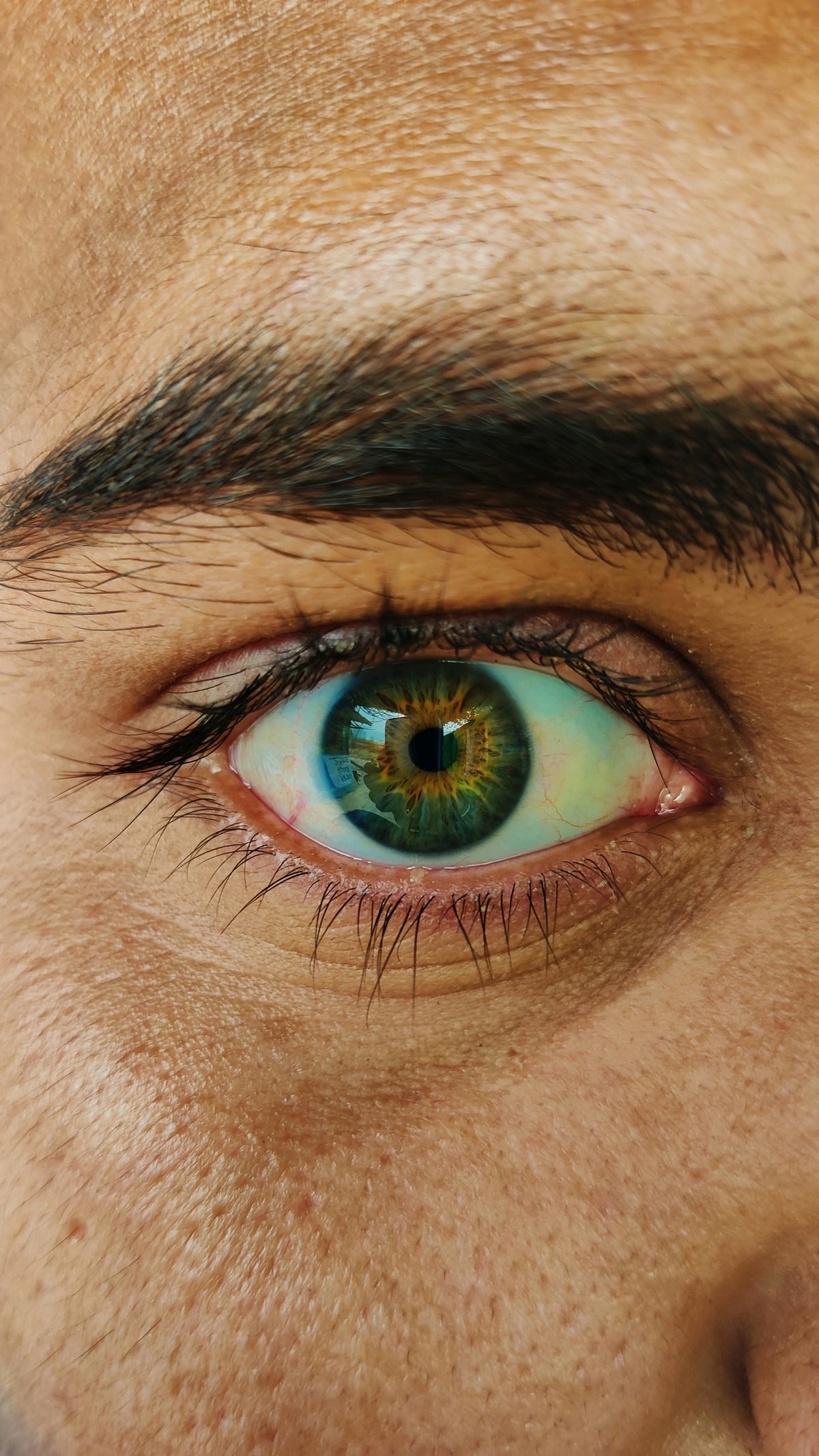 Vision